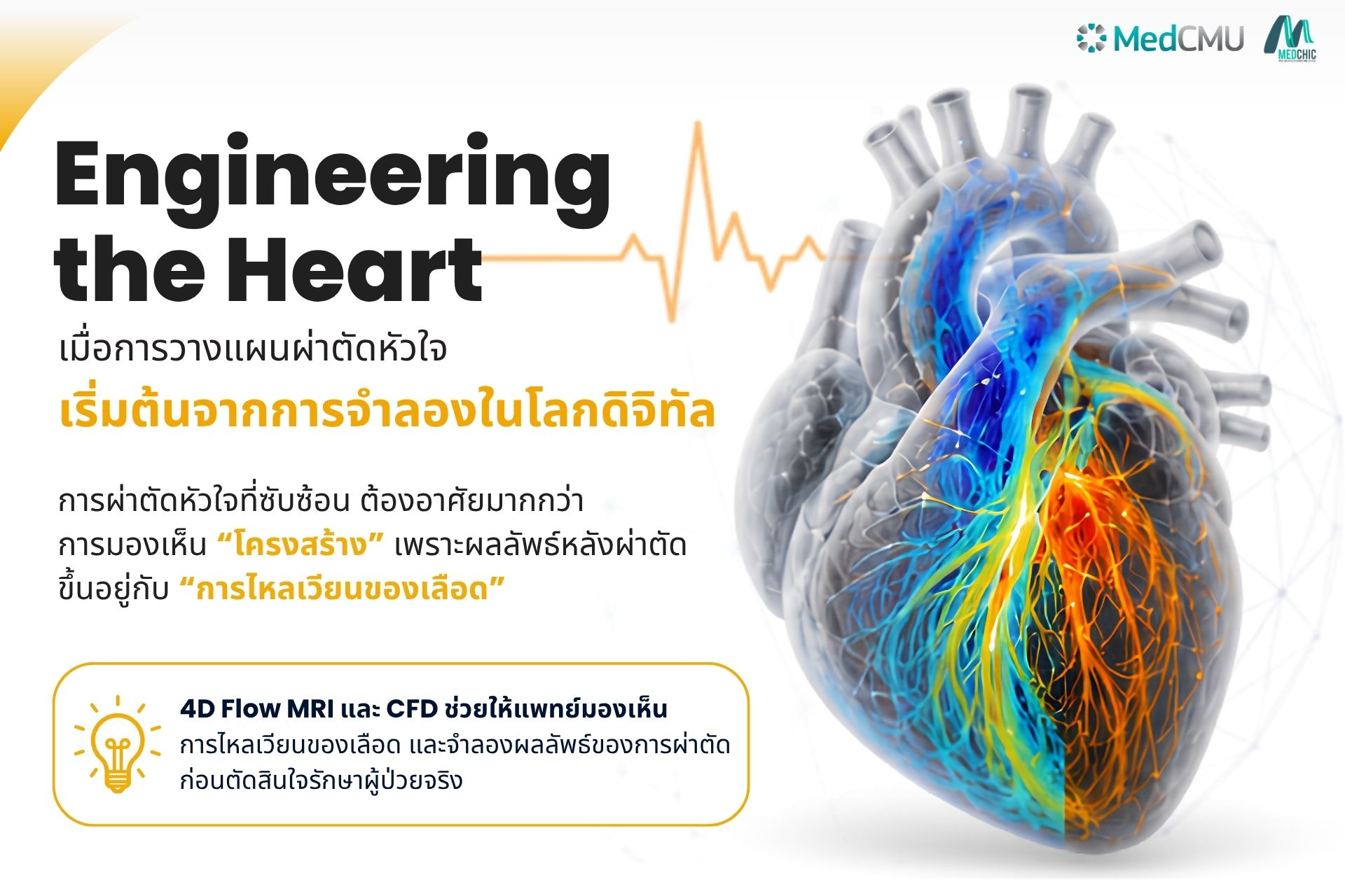 Engineering the Heart: เมื่อการวางแผนผ่าตัดหัวใจเริ่มต้นจากการจำลองในโลกดิจิทัล
