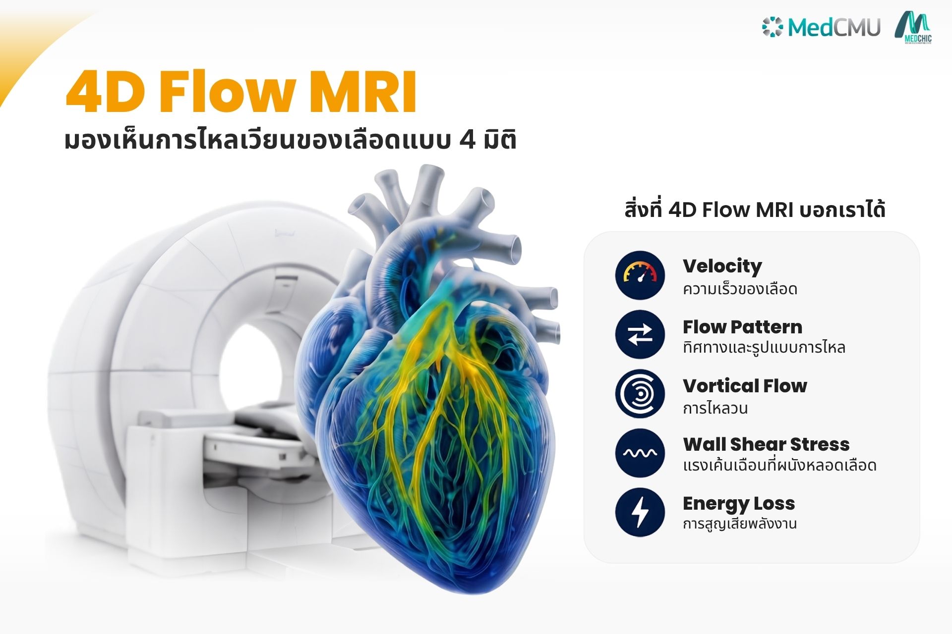 4D Flow MRI Scanner and Heart