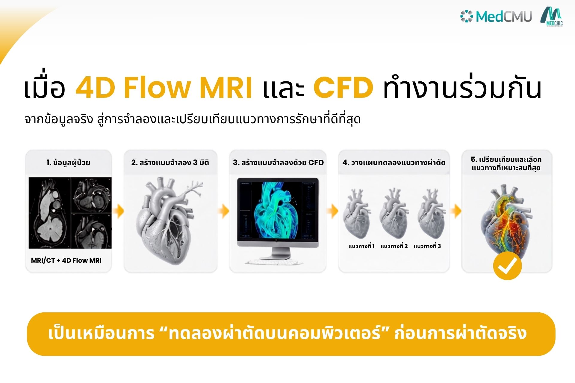 4D Flow MRI & CFD